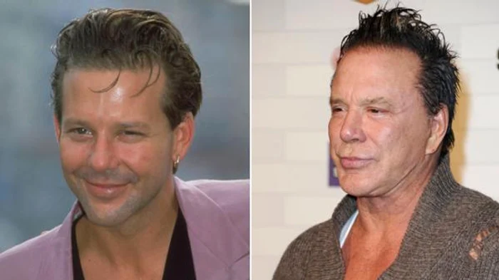 mickey rourke operatie estetica