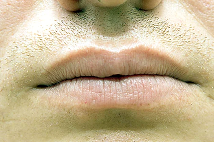 Fetelor, fiţi atente la trăsăturile feţei iubitului când vi-l alegeţi!