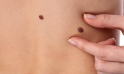 1 zilele protectiei solare 2020 jpg jpeg