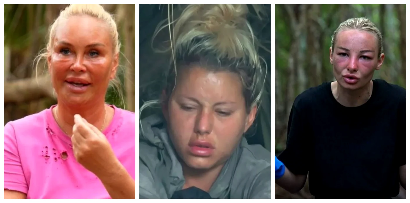 Vica Blochina, Carmen Grebenișan și Maria Lungu s-au umflat la față la Survivor România 