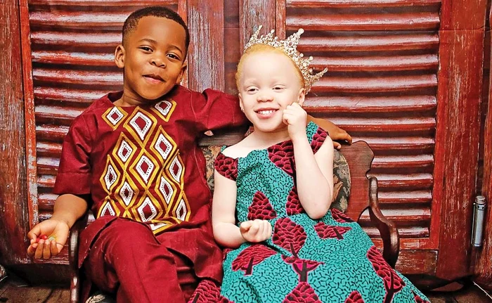 
    Kamsi şi Kachi au împlinit recent 3 anişori, dar oricât ar insista nimeni nu e convins că sunt fraţiFoto: profimedia  