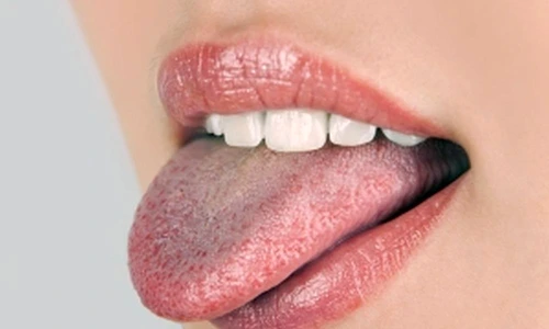 1 71851 original jpg jpeg