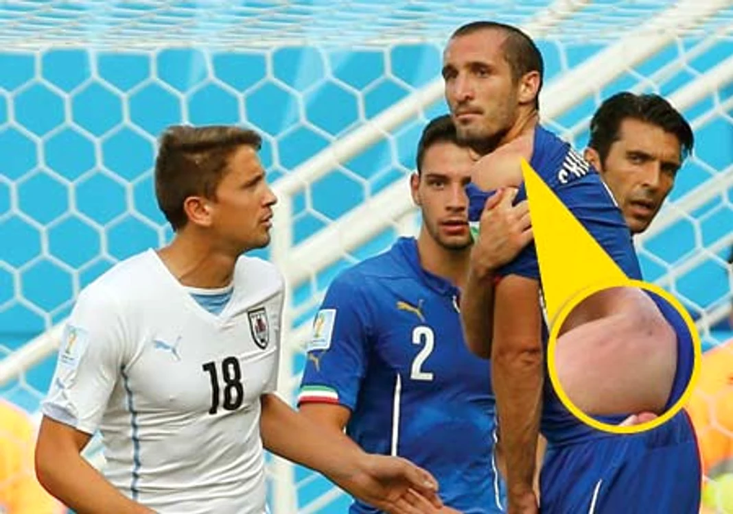 
    24 iunie 2014; Chiellini a rămas cu urmele muşcăturii pe umărul stângFotografii: Gulliver GettyImages/Reuters  