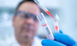 coronavirus test pandemie jpeg