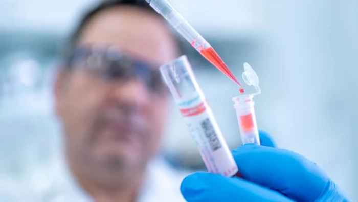 Teste COVID-19, non-stop