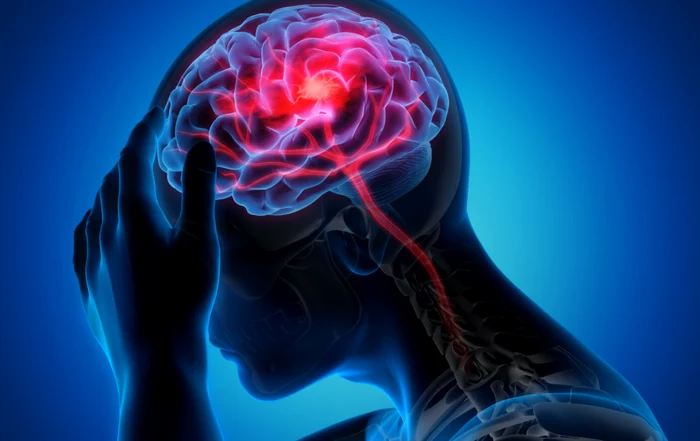Pacienţii cu AVC, afectaţi încă de lipsa centrelor de neurorecuperare Foto: Shutterstock