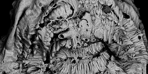 Saccorhytus coronarius