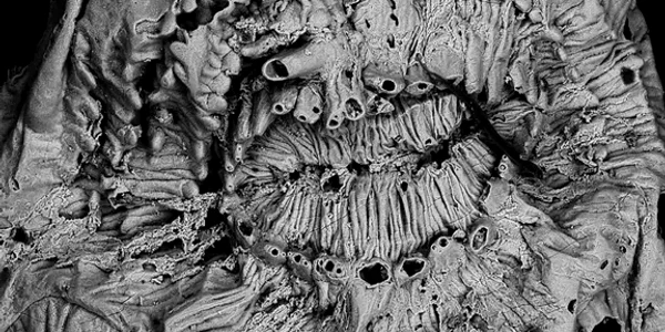 Saccorhytus coronarius