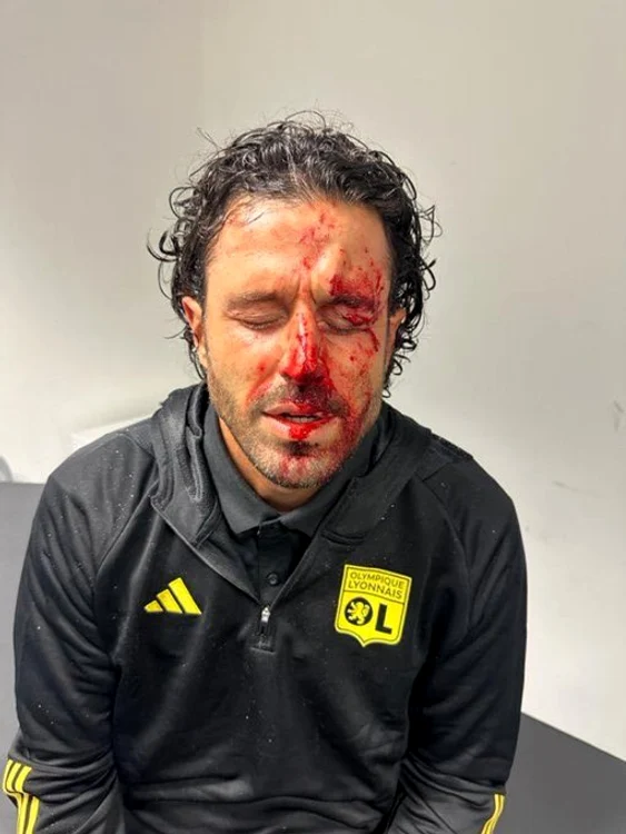 Fabio Grosso, rănit de suporteri Olympique Marseille. Foto: Nexta TV via X