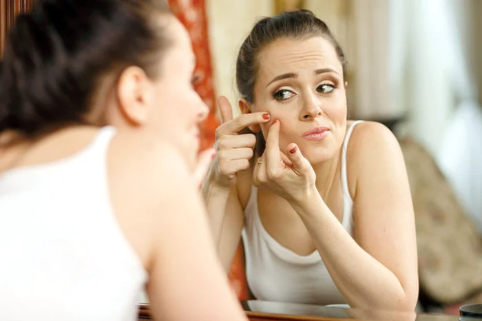 
    Cum poți scăpa de acneeFoto: 123.rf  