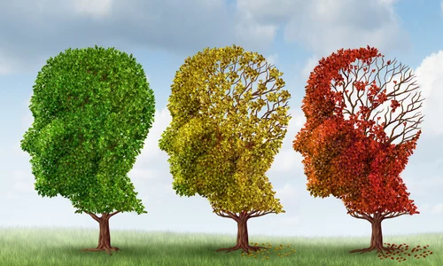 demența  foto   Shutterstock jpg