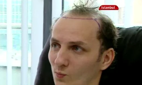 transplant de par mihai traistariu3 jpeg