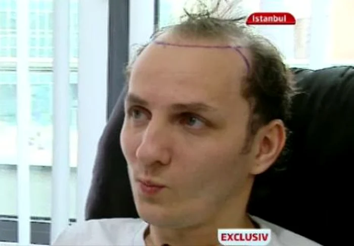 transplant de par mihai traistariu3 jpeg