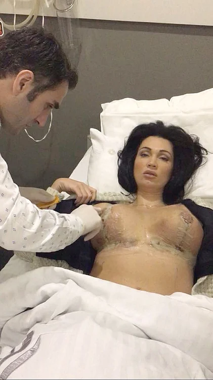 2015: Vedeta își micșorează sânii la o clinică din Turcia