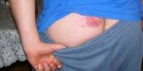 Hoţ de lemne împuşcat depădurar