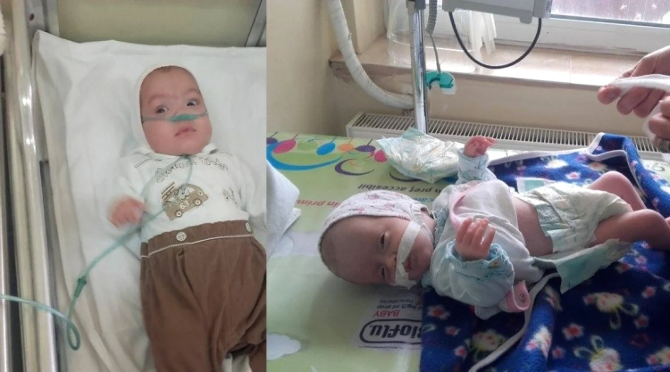 Cele două fetiţe au fost abandonate la naştere din cauza problemelor medicale FOTO: Mădălin Sofronie