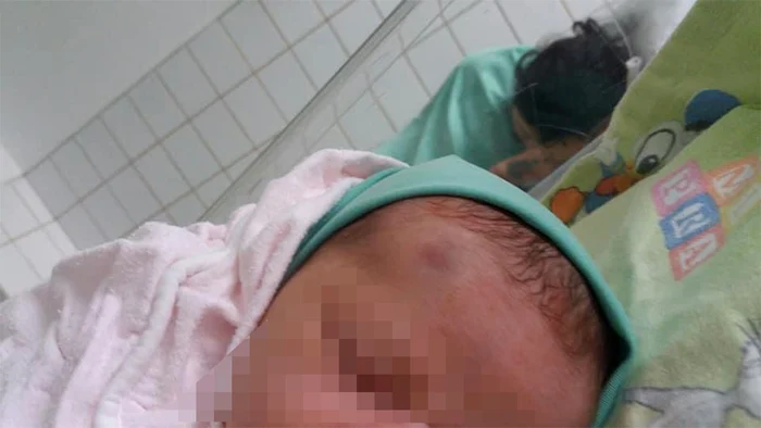 Fetița scăpată în cap la naștere nu a rămas cu sechele