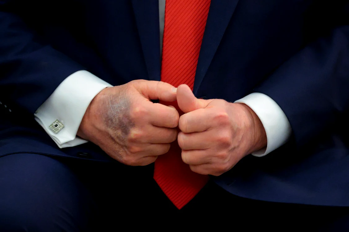 Donald Trump cu mâini vinete, Foto GettyImages (1) jpg