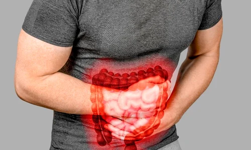 sindromul colonului iritabil jpg