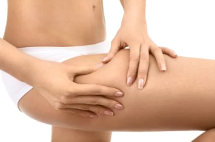 
    Femeile supraponderale pot suferi de celulită infiltrată  