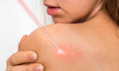 1 de ce apar negii jpg jpeg