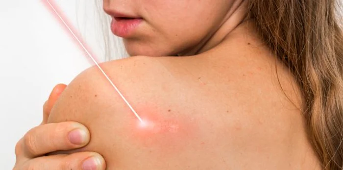 1 de ce apar negii jpg jpeg