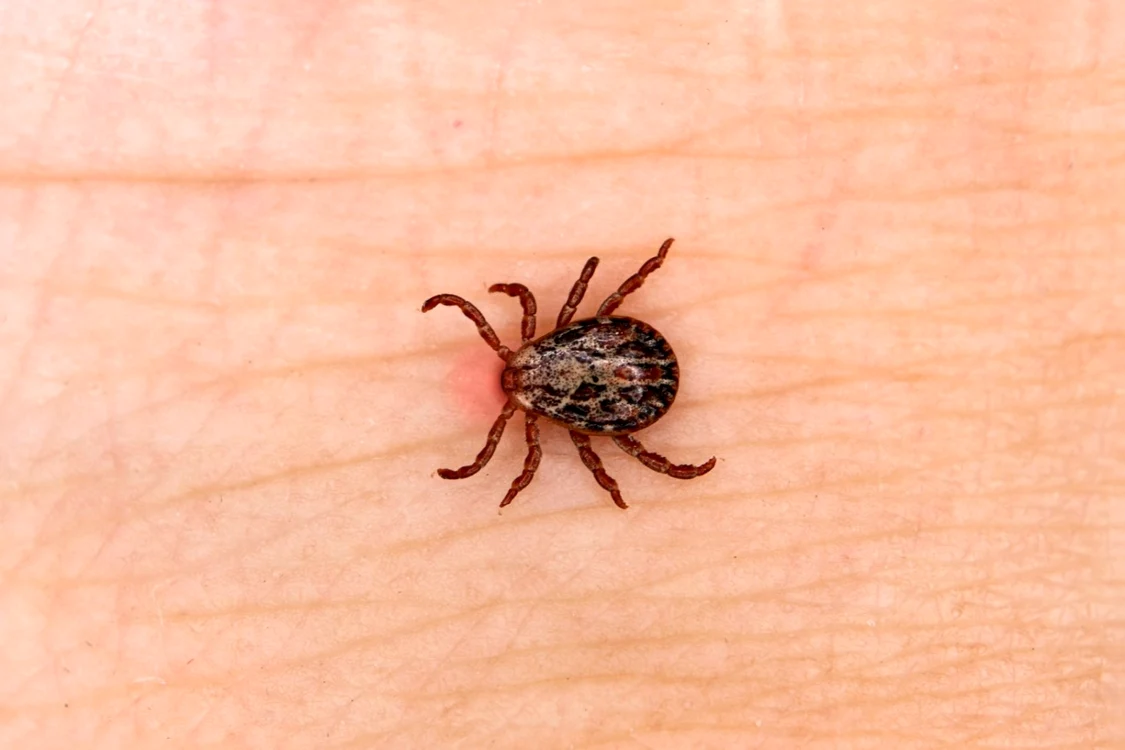 Borelioza Lyme sau boala Lyme este o maladie infecţioasă transmisă la oameni prin înţepăturile căpuşelor infectate FOTO Shutterstock