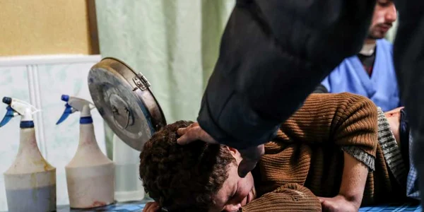 Un băiat rănit primeşte tratament în spital după mai multe atacuri aeriene la Douma Siria FOTO EPA-EFE / Mohhamed Badra