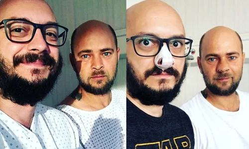 Cosmin şi Cătălin s au operat pentru a rezolva problema unei deviaţii de sept  jpeg