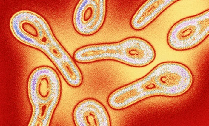 Două cazuri de difterie, confirmate în România / foto: arhiva