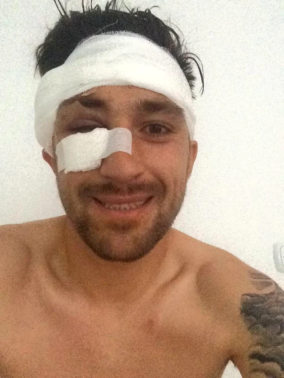 Paul Papp, după operaţie jpeg