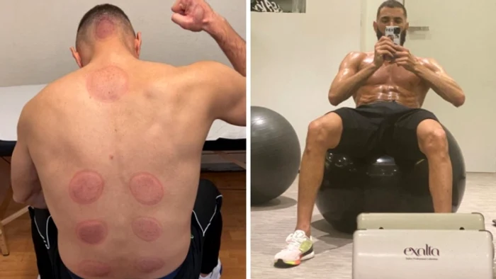 Benzema folosește des ventuzele