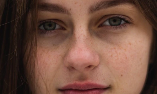 1 solutii impotriva cearcanelor jpg jpeg