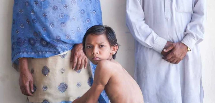 Încă de la naştere, Arshid a fost considerat reîncarnarea zeului hindu Maimuţă, Hanuman, iar oamenii veneau la el să se roage şi să-i lase bani în speranţa că li se vor îndeplini dorinţele. FOTO Daily Mirrror