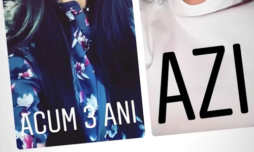 9 mirela de la insula iubirii interventii estetice 4 jpg jpeg