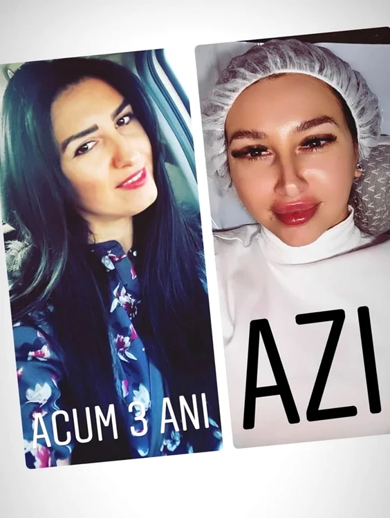 9 mirela de la insula iubirii interventii estetice 4 jpg jpeg