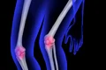human bone pixabay jpg