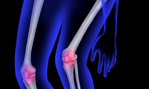 human bone pixabay jpg