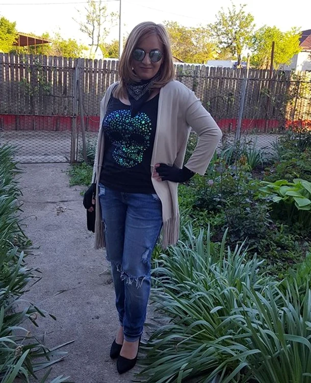 Corina poartă mănuși speciale după arsurile suferite