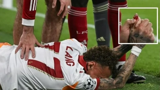 Accidentare oribilă suferită de olandezul Noah Lang la meciul Liverpool - Galatasaray: „Îi lipsește o bucată din vârful degetului mare”