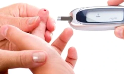 1 75055 original jpg jpeg