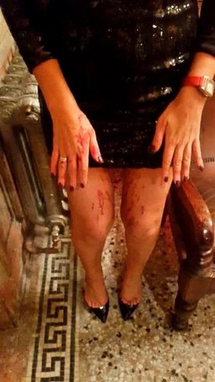 Maria Folwer a fost atacată într-un clubFoto: mirror.co.uk