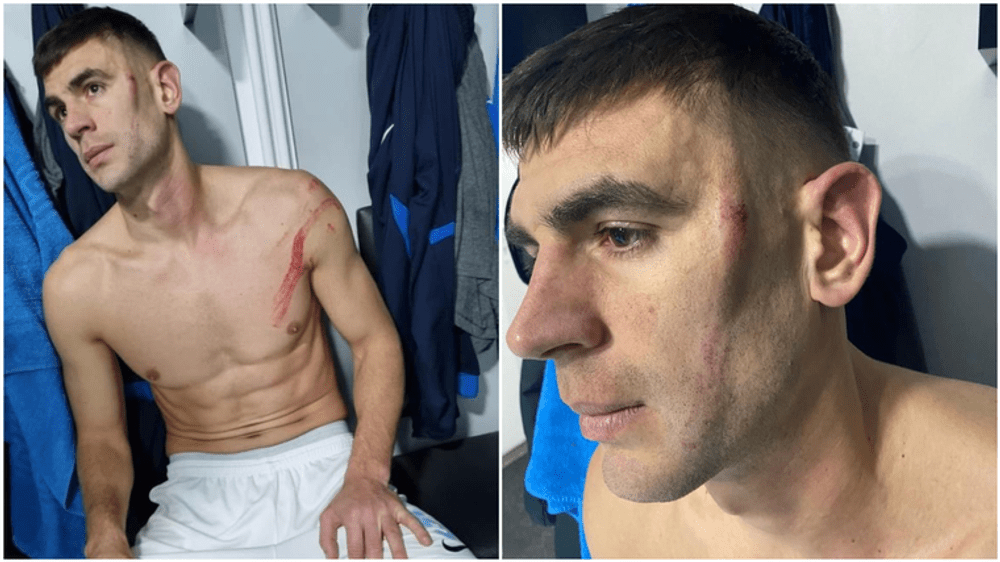 Acuze grave după faza brutală care a șocat România: Armaș, desfigurat, a dat un interviu exploziv VIDEO