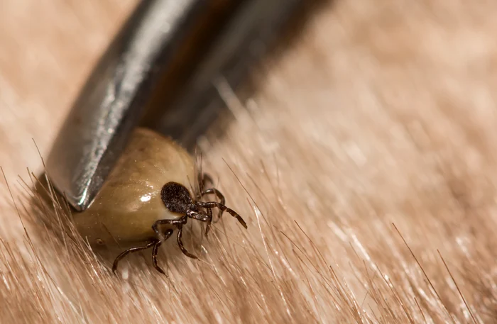 Poți avea mereu cu tine croșeta sau penseta pentru îndepărtarea căpușelor