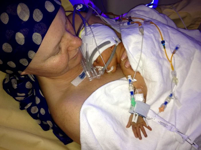 
    Clare Wolfswinkel a învins diagnosticul medicilorFoto Caters  