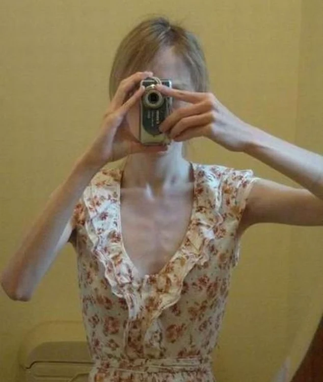 Anorexicele sunt sexy?