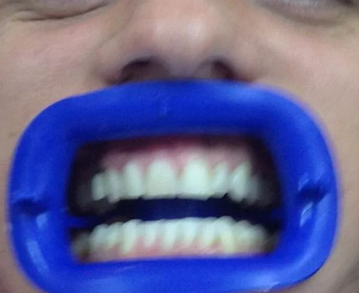 Cântăreţul va deveni un client fidel al cabinetului stomatologicfoto: Facebook