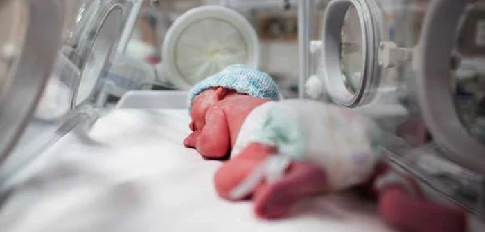 Nou născut cu malformaţii grave Sursa foto: facebook.com/www.spitaljbm.ro
