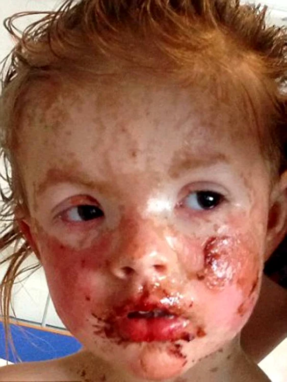 
    Micuţa Macey Marsh a  trecut prin clipe cumplite  