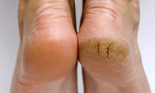 shutterstock 2069092190 jpg